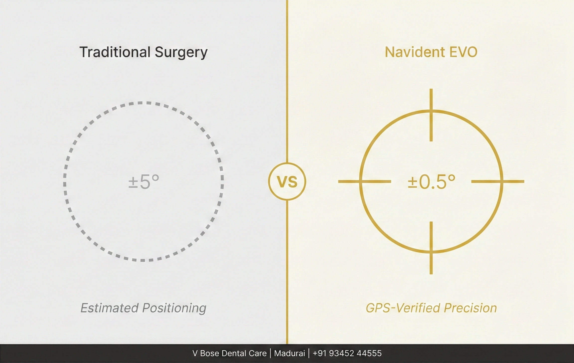 V Bose Dental Care Computer Guided Dental Implants in Madurai: Why Navident EVO Navigation Delivers Better Results Than Traditional Surgery